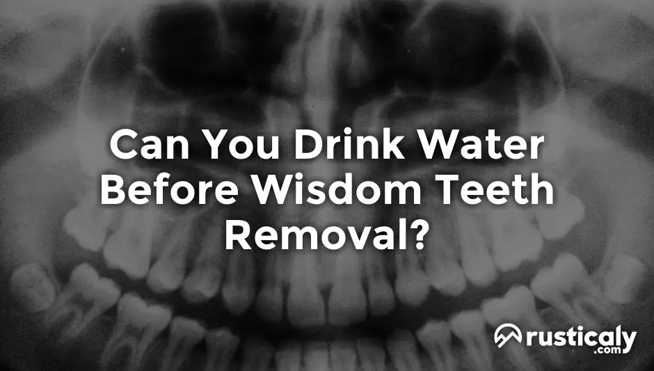 can you drink water before wisdom teeth removal