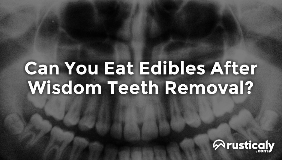 can you eat edibles after wisdom teeth removal
