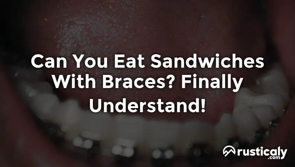 can you eat sandwiches with braces