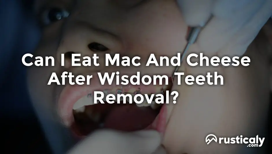 can i eat mac and cheese after wisdom teeth removal
